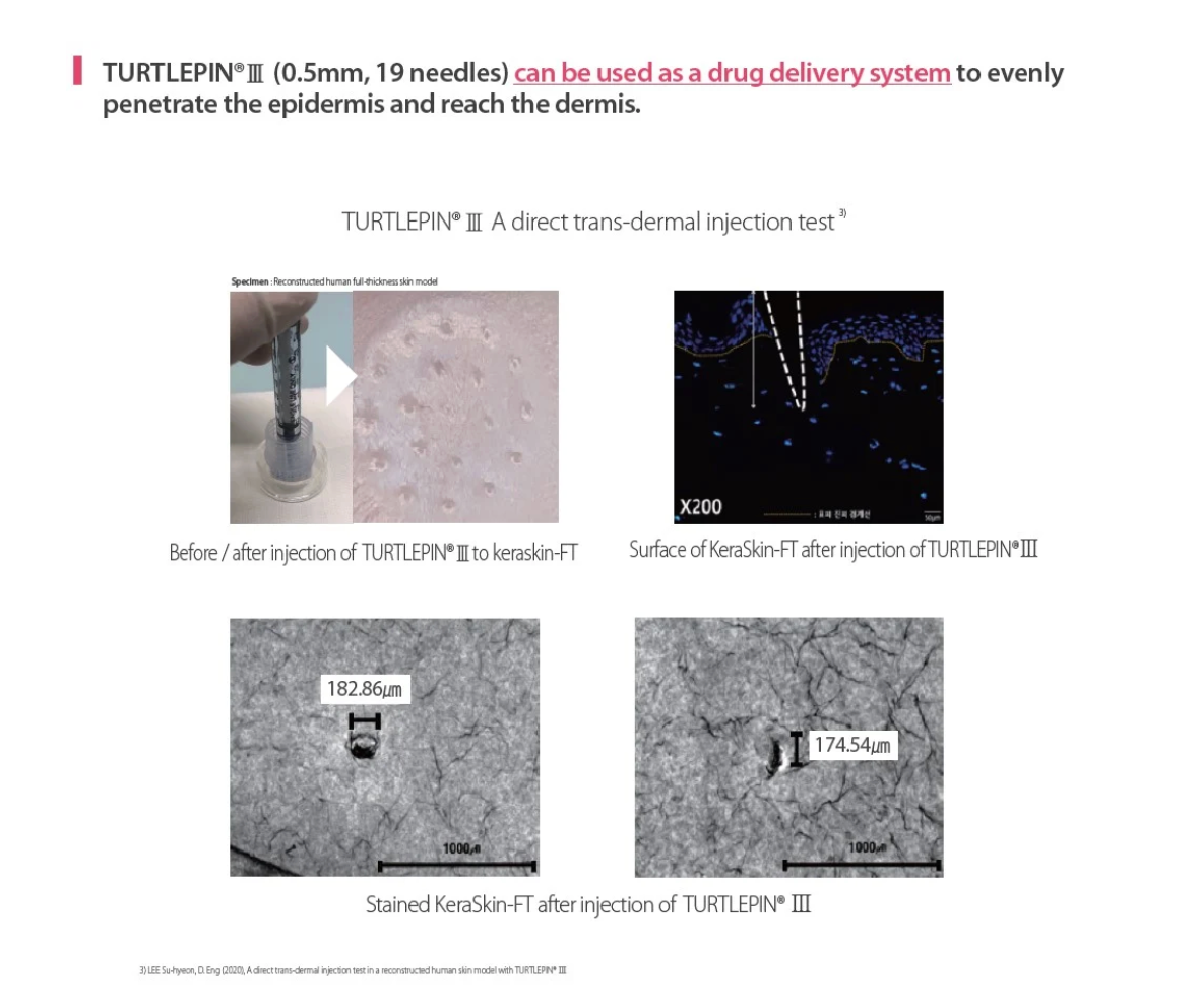 The DermaSource - TURTLEPIN III Stamping Needles(3EA) + Syringes(3EA) Set: 0.5mm