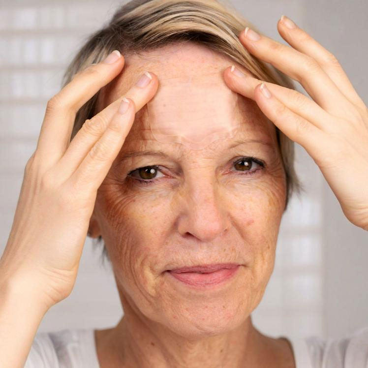 Eyederm Microneedle Forehead Patches