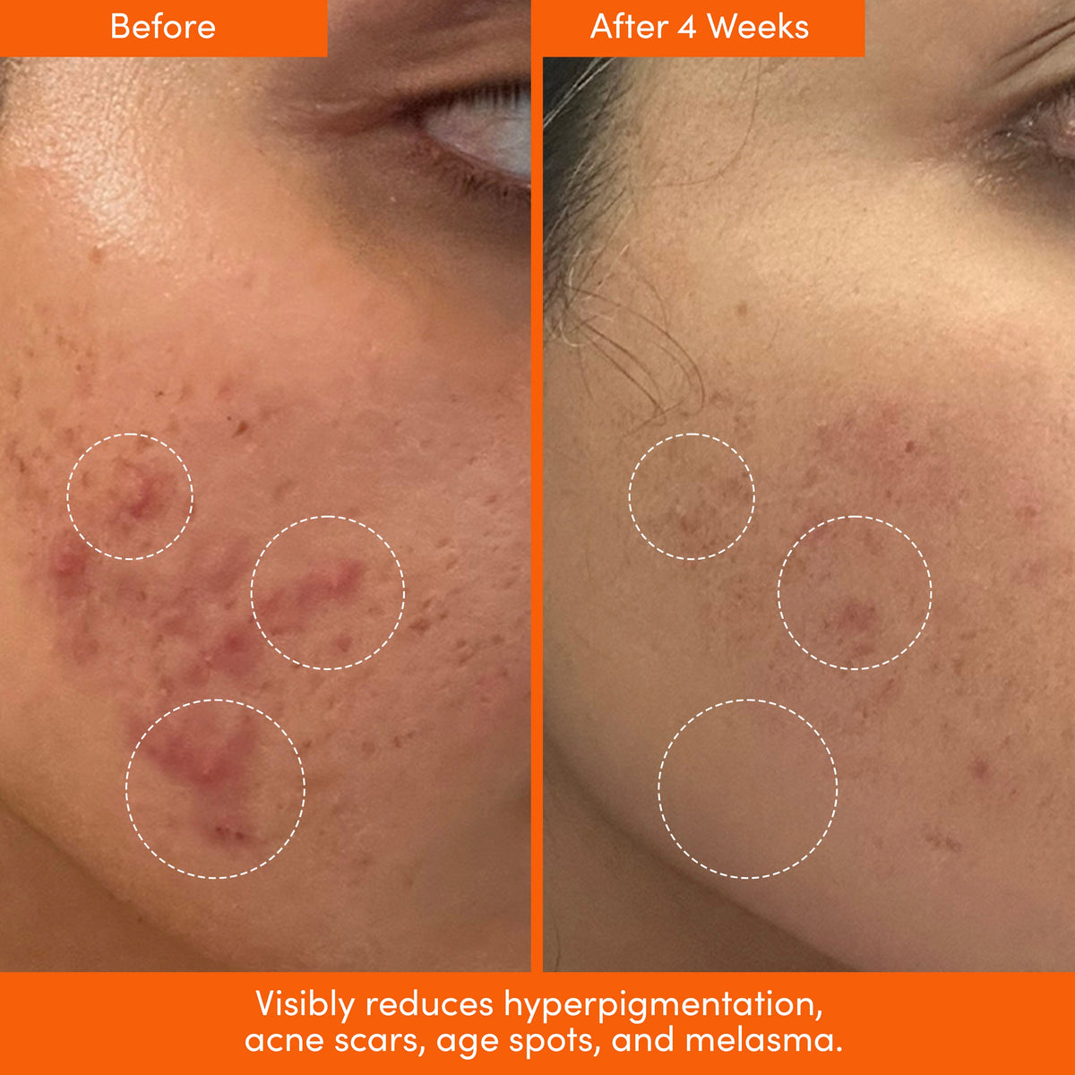 Lion Pose Placenta Facial: Dark Spot Serum + Barrier Cream
