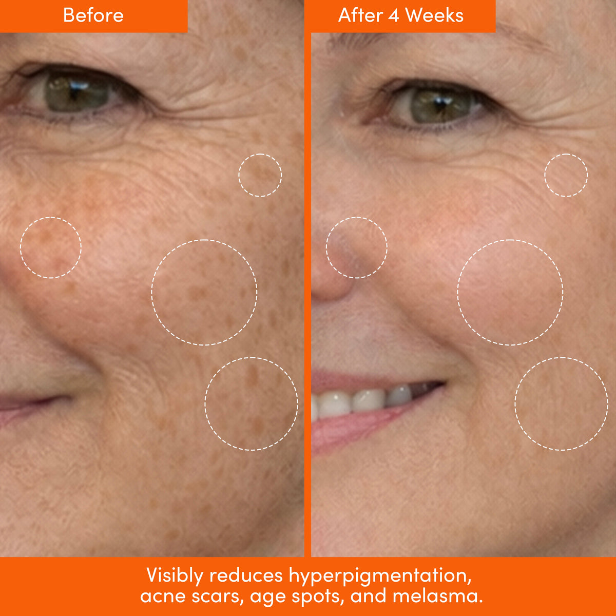 Lion Pose Placenta Facial: Dark Spot Serum + Barrier Cream