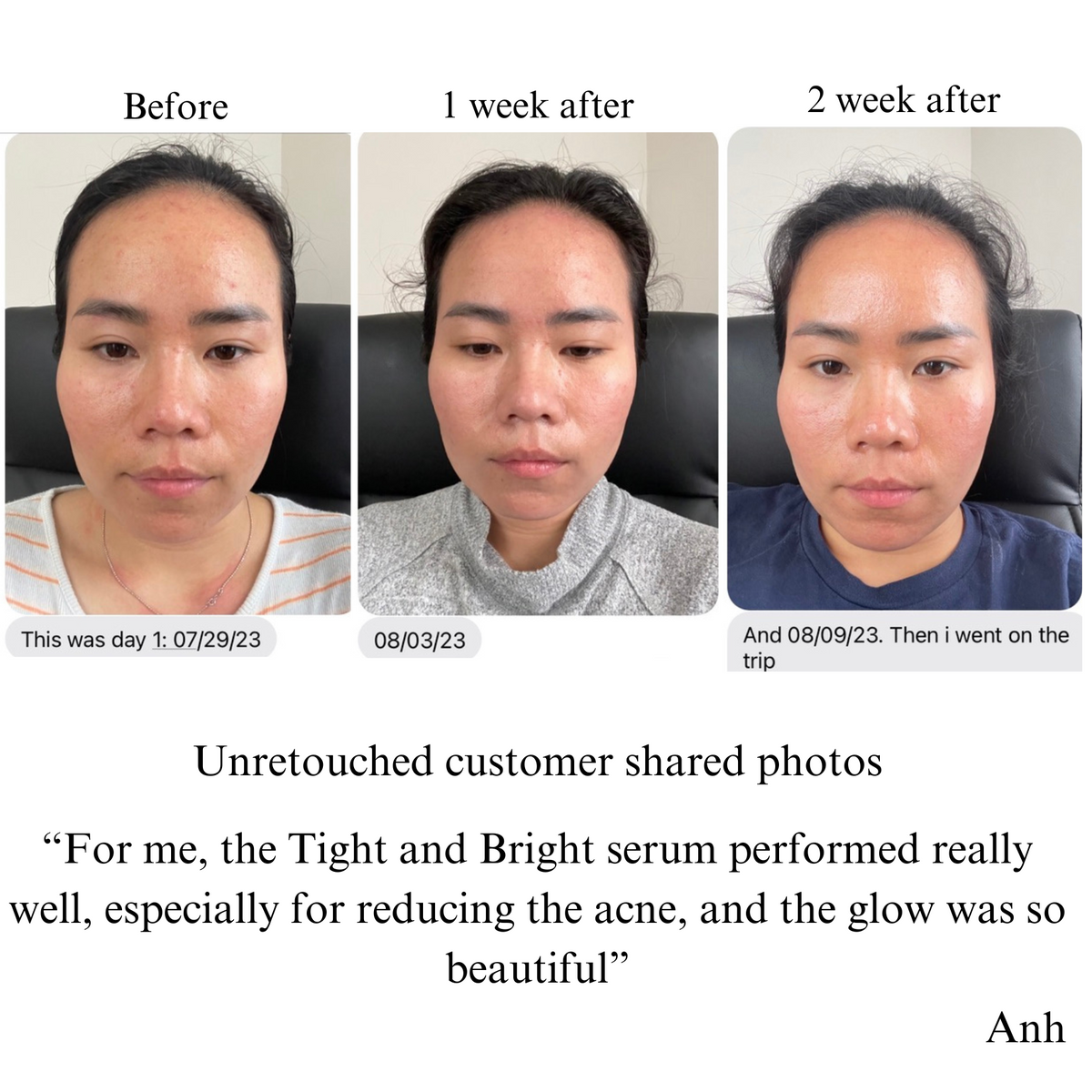 NILCEUTICA Tight & Bright Phyto-Retinol + Vitamin C Serum