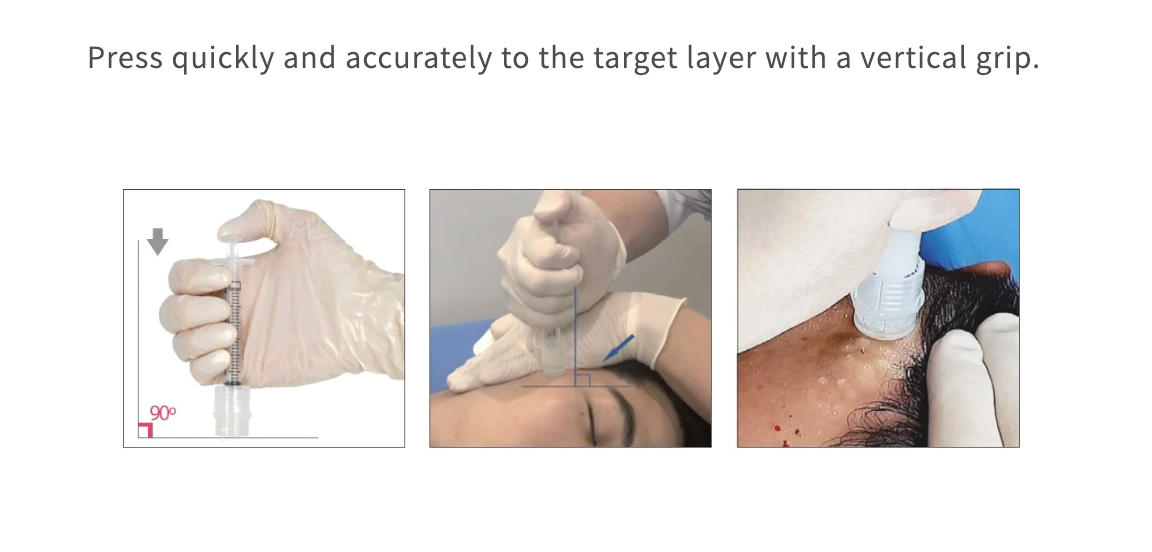 The DermaSource - TURTLEPIN III Stamping Needles(3EA) + Syringes(3EA) Set: 0.5mm
