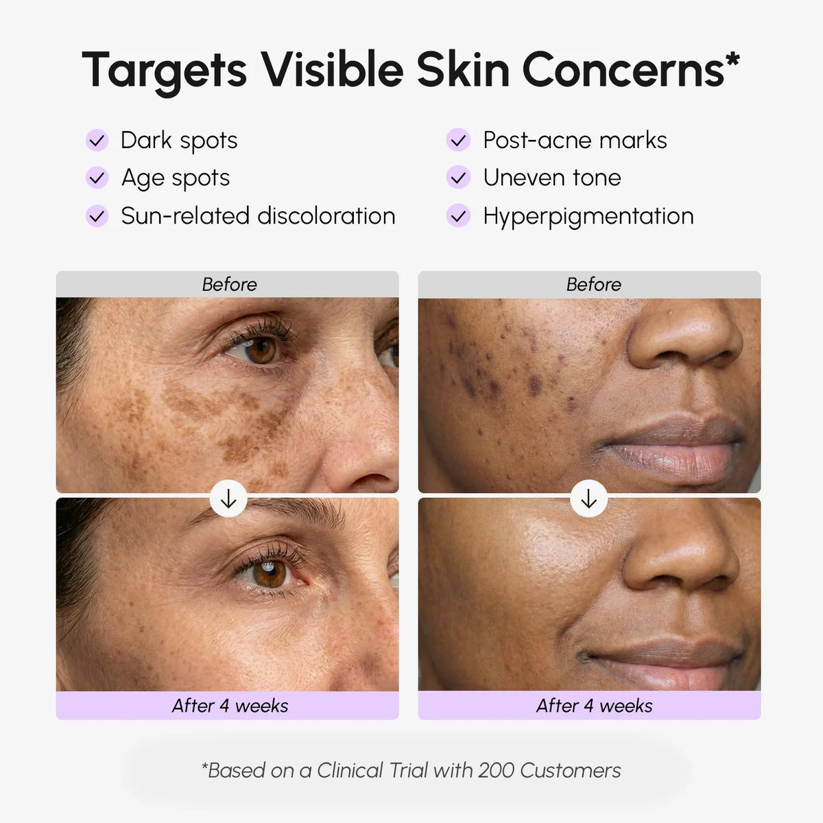 Maree Face & Body Serum for Dark Spots