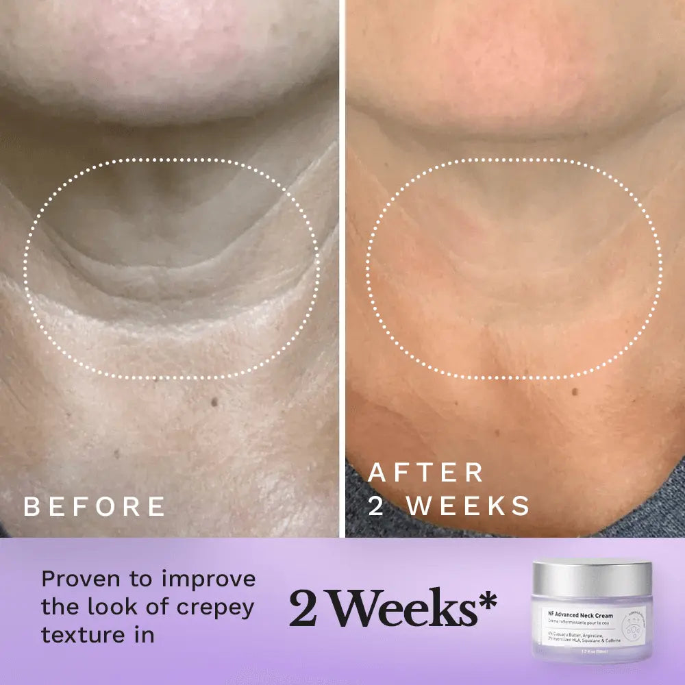 NF Advanced Neck Cream