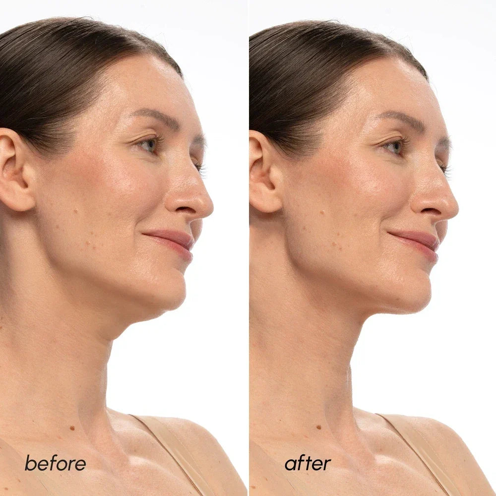 Maree PDRN V-Line Lifting Mask