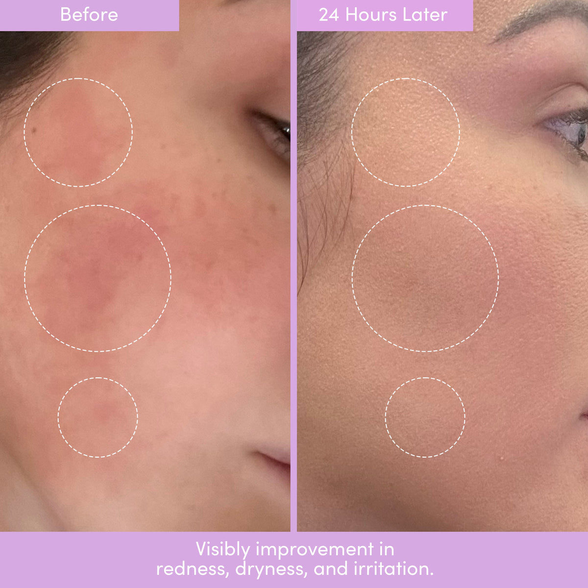 Lion Pose Placenta Facial: Dark Spot Serum + Barrier Cream
