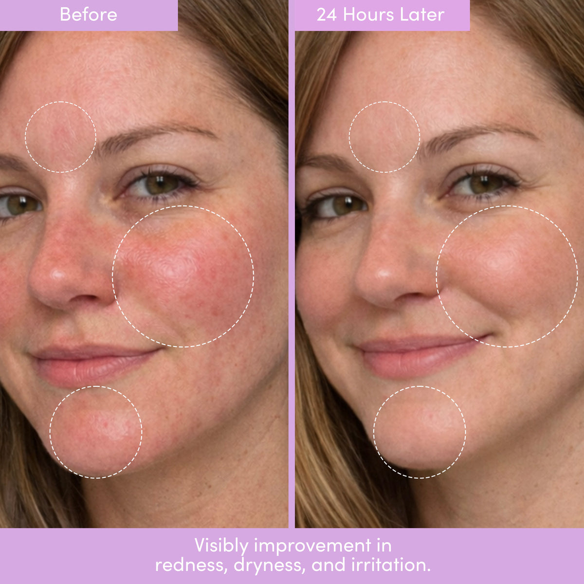 Lion Pose Placenta Facial: Dark Spot Serum + Barrier Cream