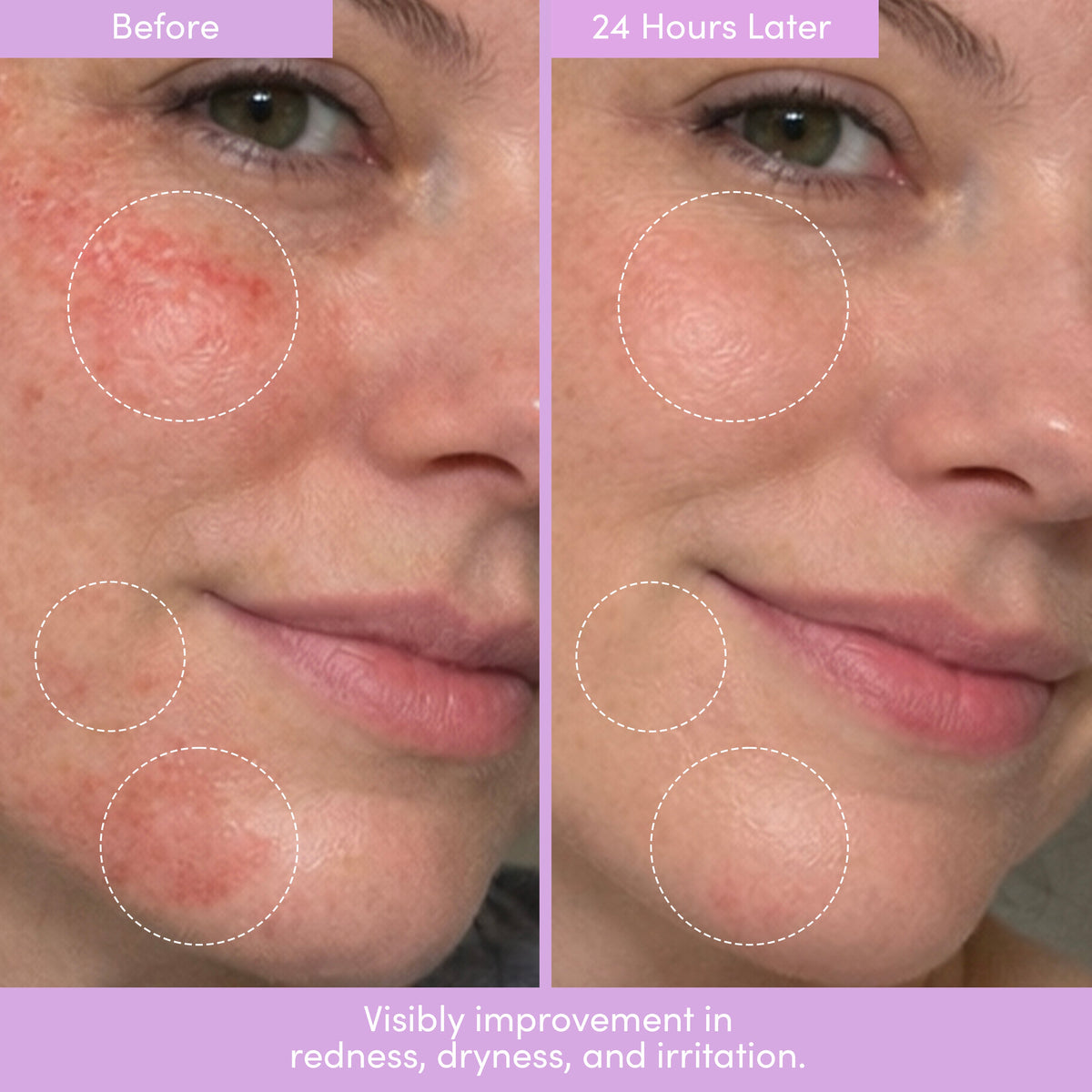 Lion Pose Placenta Facial: Dark Spot Serum + Barrier Cream
