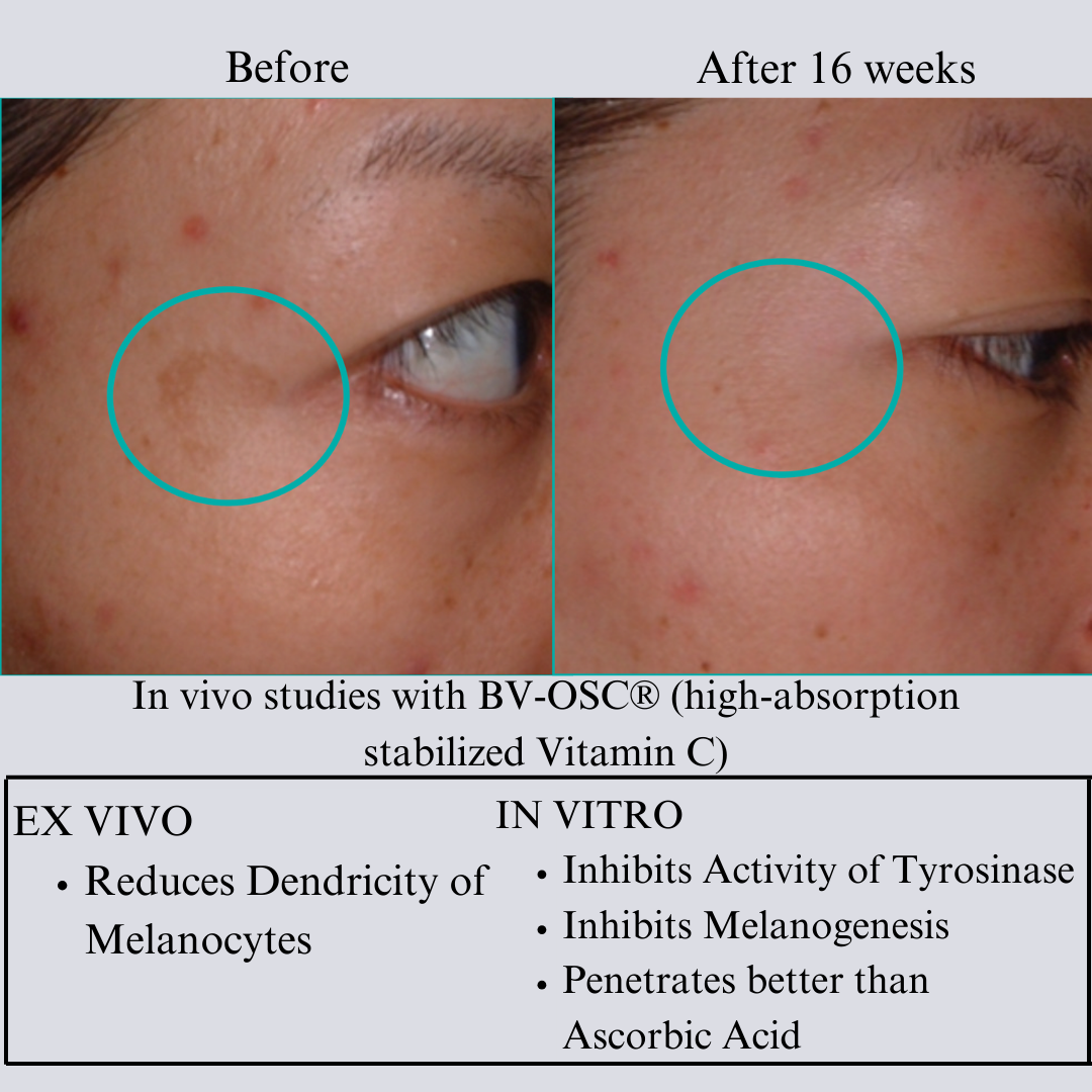 NILCEUTICA Tight & Bright Phyto-Retinol + Vitamin C Serum