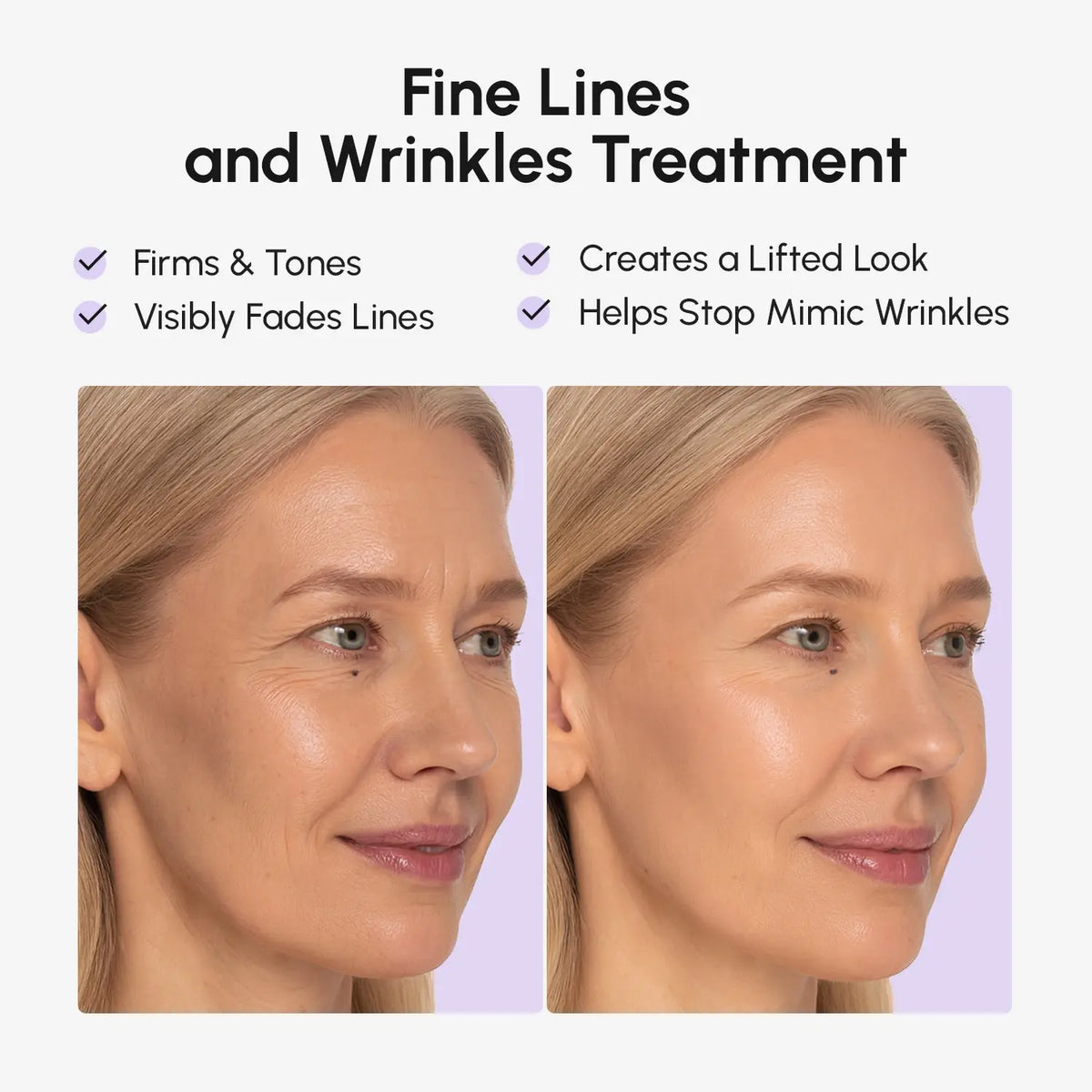 Maree Anti-Wrinkle Face Tape Patches