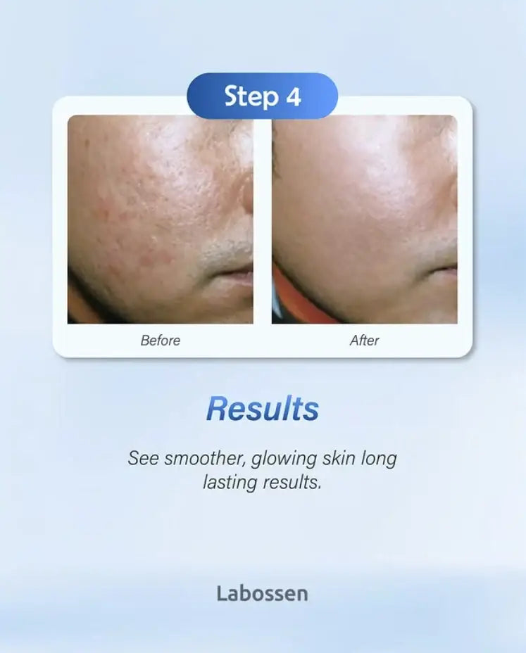 The DermaSource - Labossen Bio-Xome Skin - Powder and Diluent Set (1 Kit)